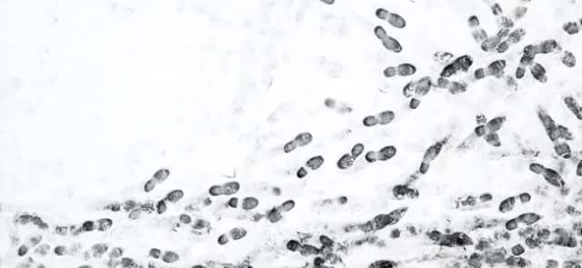 Stochastic processes: